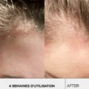 touche-skincare-lab-250ml-shampoing-anti-psoriasis-45659623981336