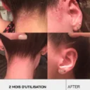 touche-skincare-lab-250ml-shampoing-anti-psoriasis-45659624046872