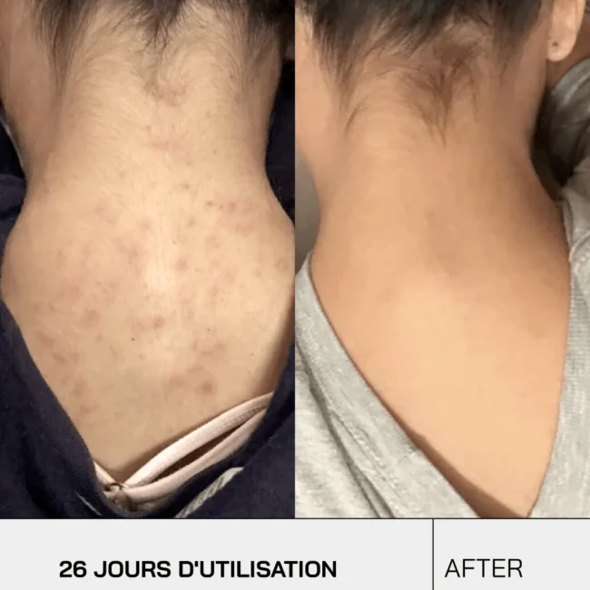 touche-skincare-lab-default-title-gel-douche-nettoyant-anti-imperfections-45659024818456_2048x2048