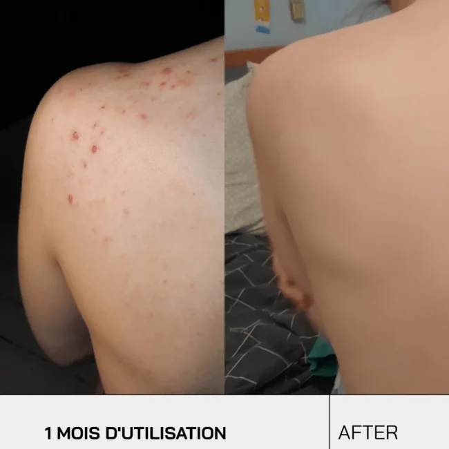 touche-skincare-lab-default-title-gel-douche-nettoyant-anti-imperfections-45659025211672_2048x2048